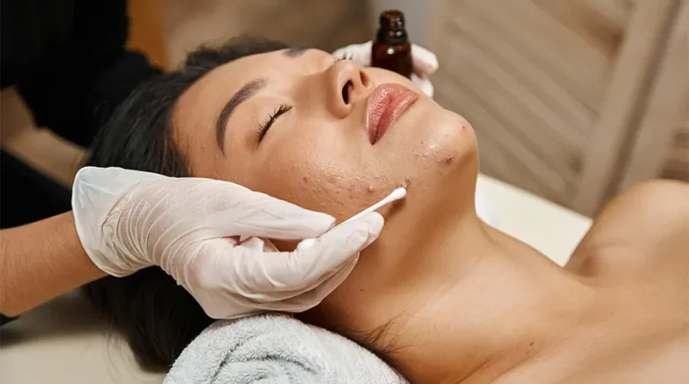 Anti-Acne Facial Treatment for Men.