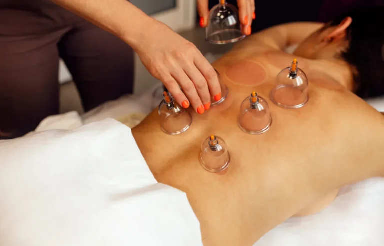 Cupping Massage