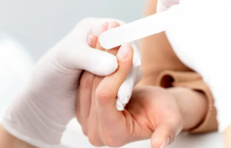 Gel Removal